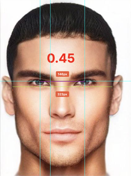 Is IPD bizygomatic ESR A Bad Ratio A New Ratio For Eye Spacing 