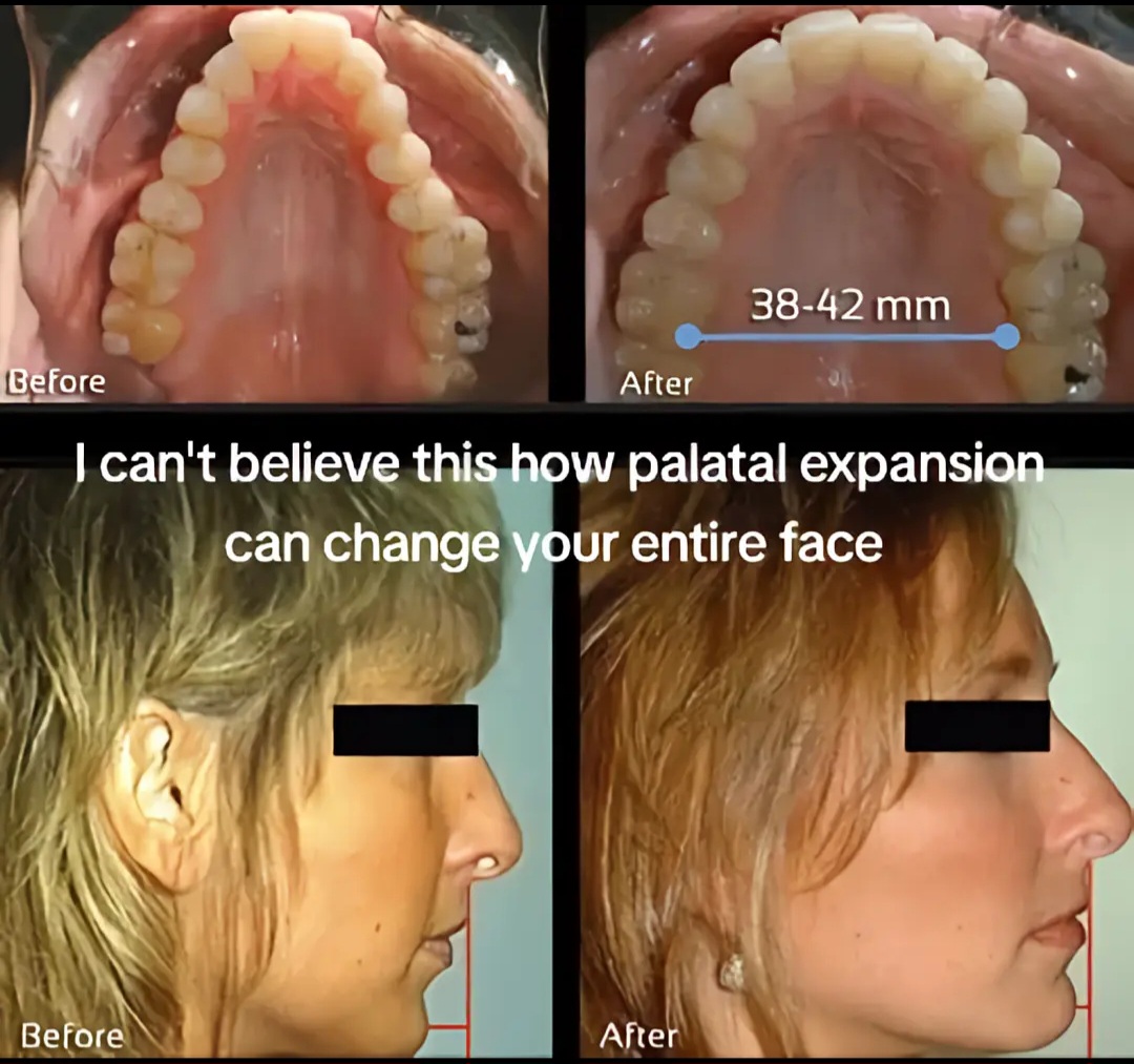 1000027502