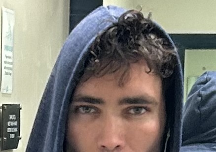 Eyebotox2