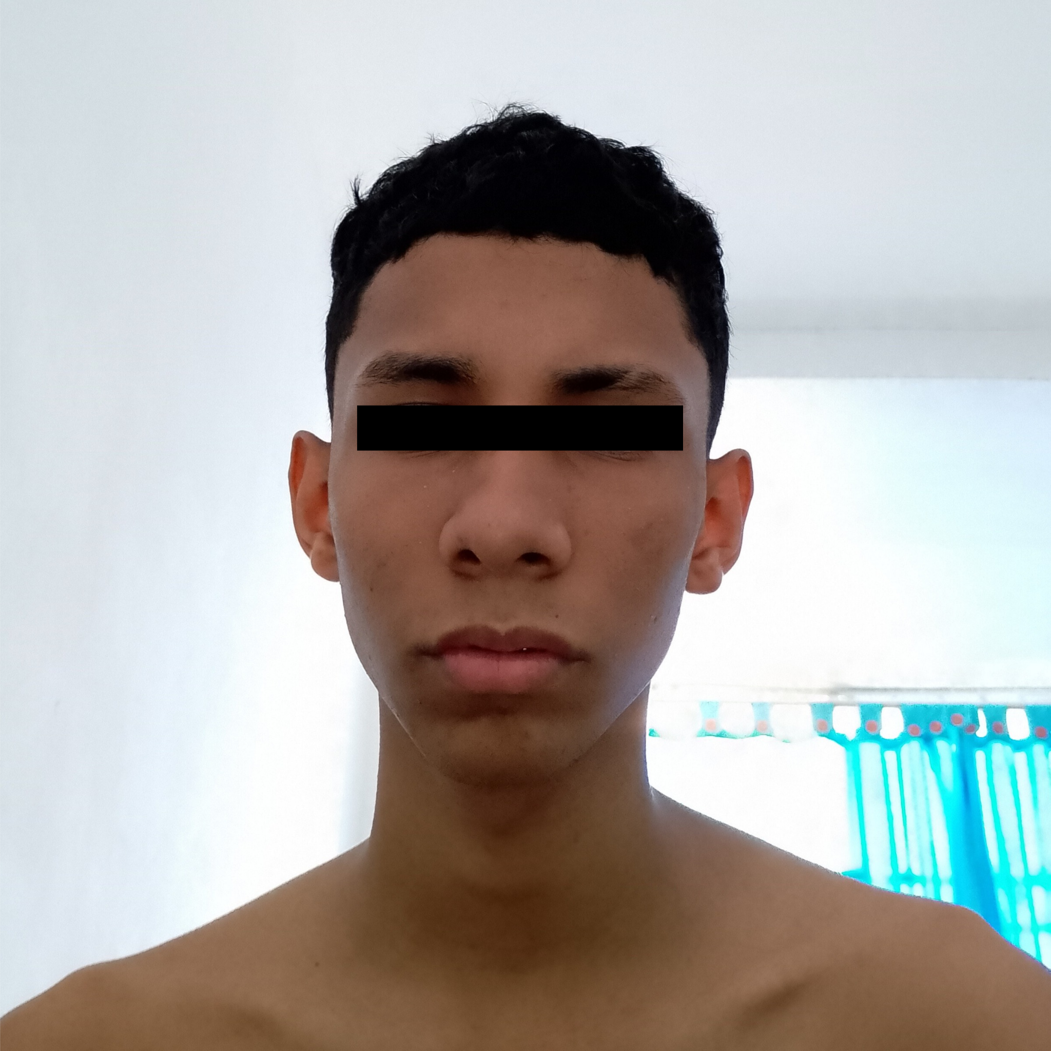 1000051264