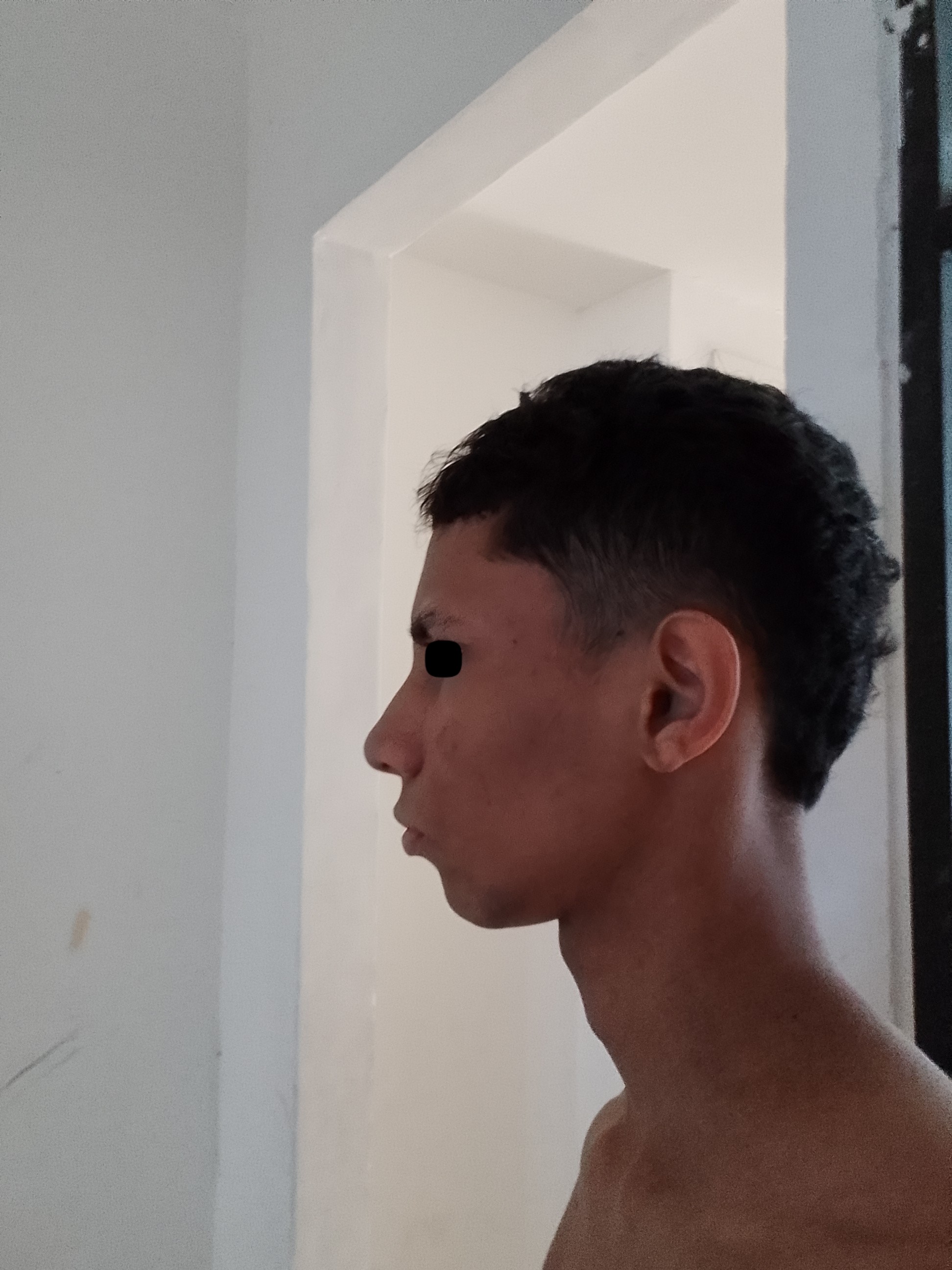 1000051265