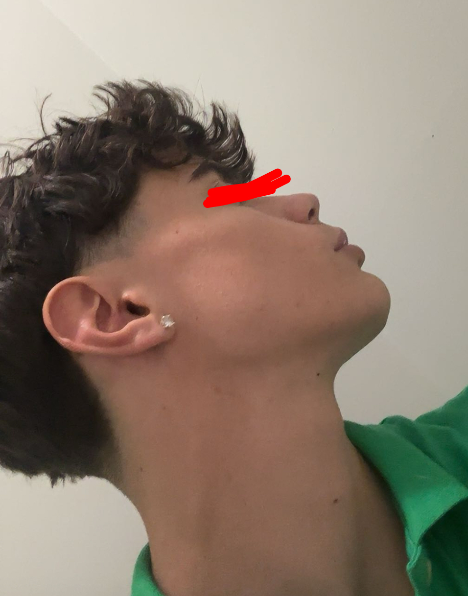IMG 1523