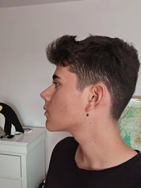 24