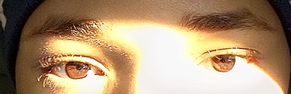 1000037056 1000037056