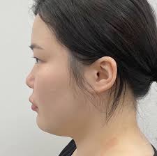 IMG 4197