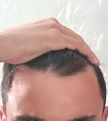 1000054893