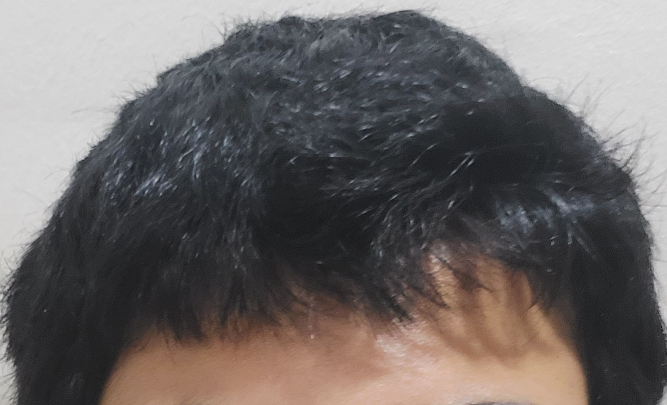 20250703 193010