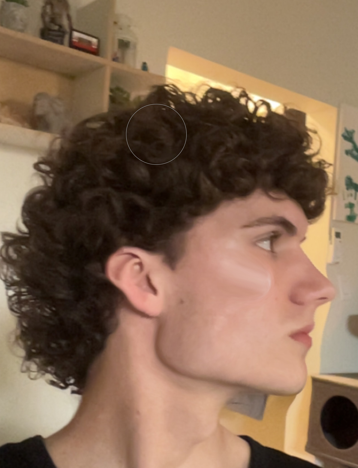 Fnnt