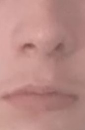 Lips 1