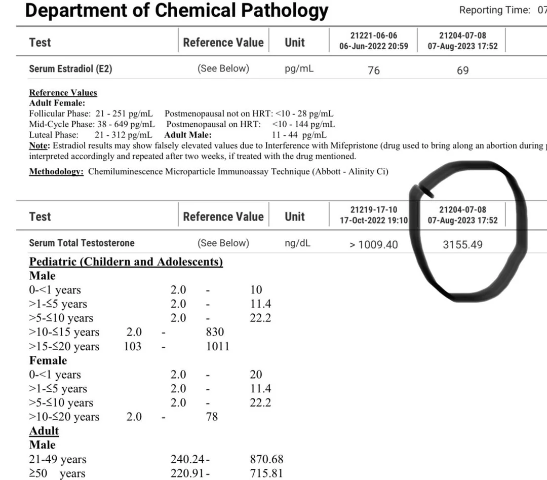 3000 ng dl testosterone levels on just 250mg week of test e v0 zvzm3sh9gygb1