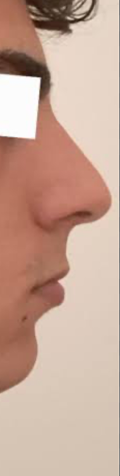 IMG 0263