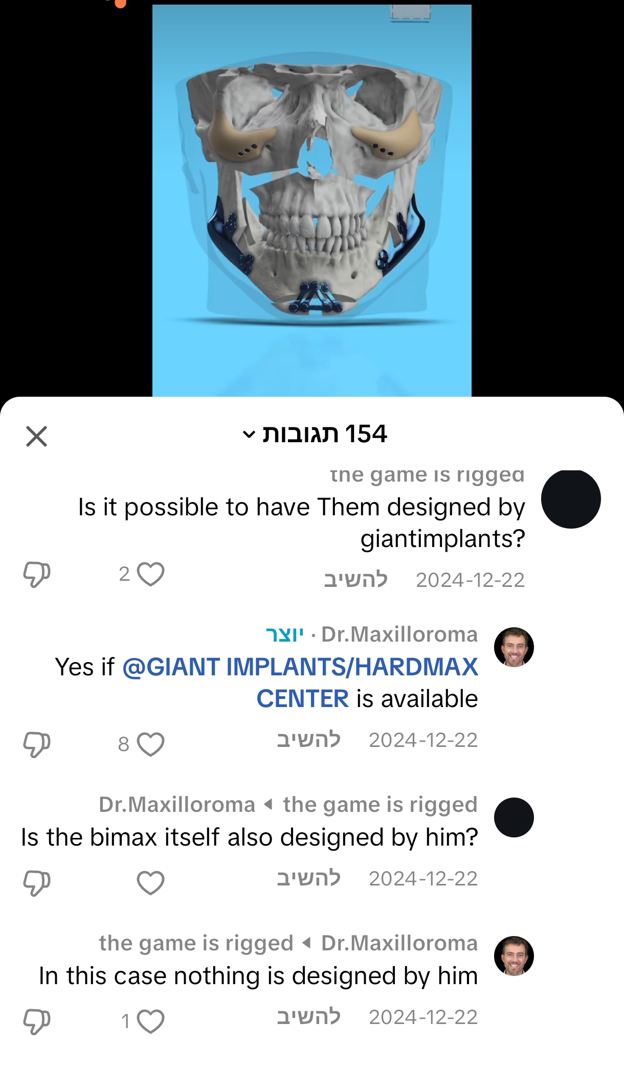 1000002314