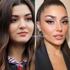 Berk Yılmaz | Hande Erçel ve değişimi 💉 Güneşin Kızları dizisinde  canlandırdığı Selin karakteriyle adını geniş kitlelere duyurmayı başaran  Hande,... | Instagram