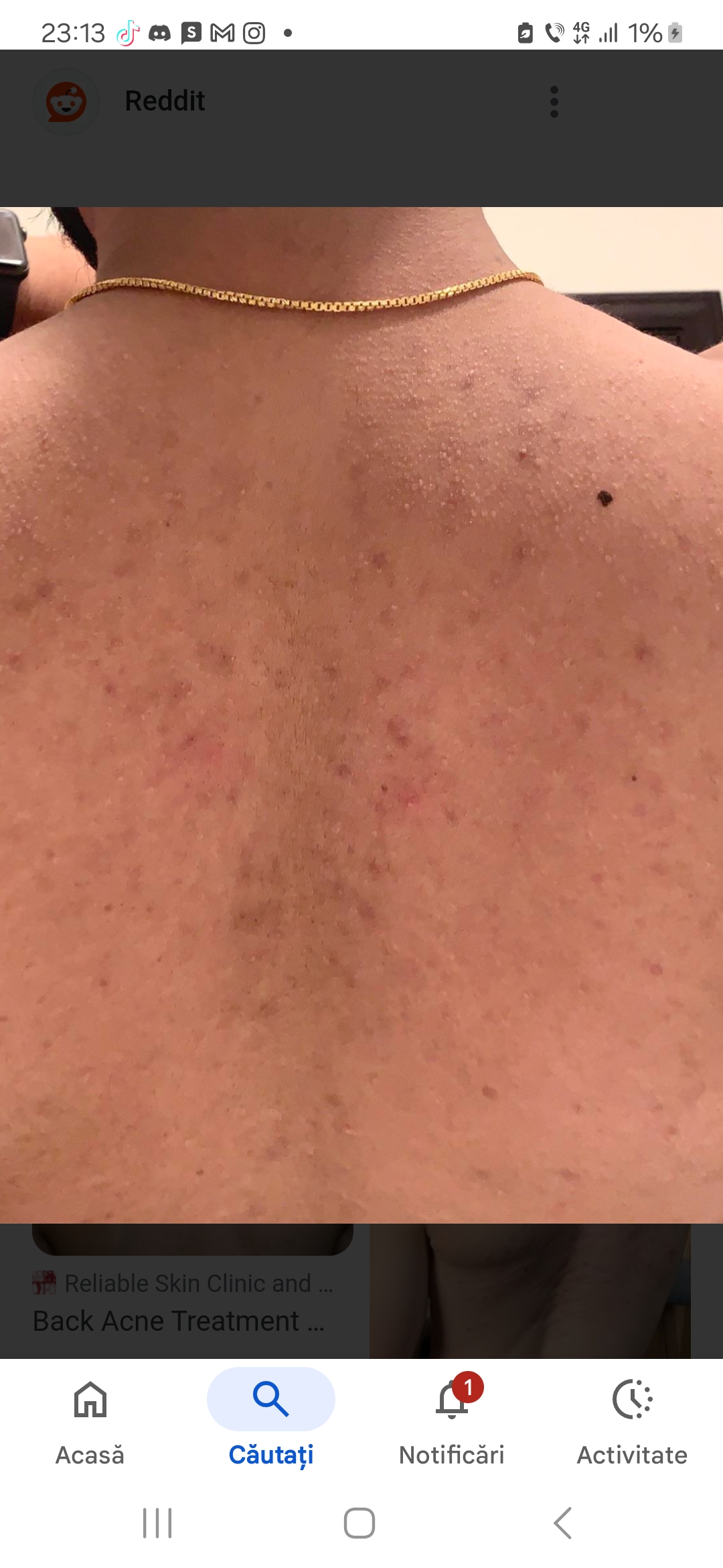 1000048051