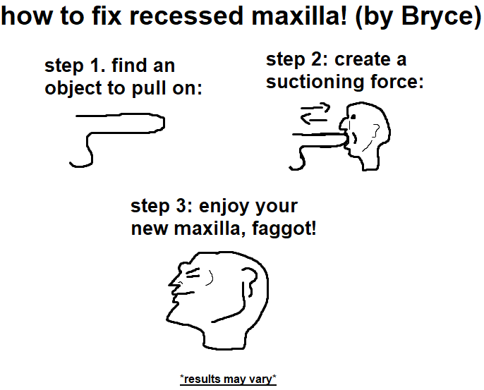 Newmaxilla