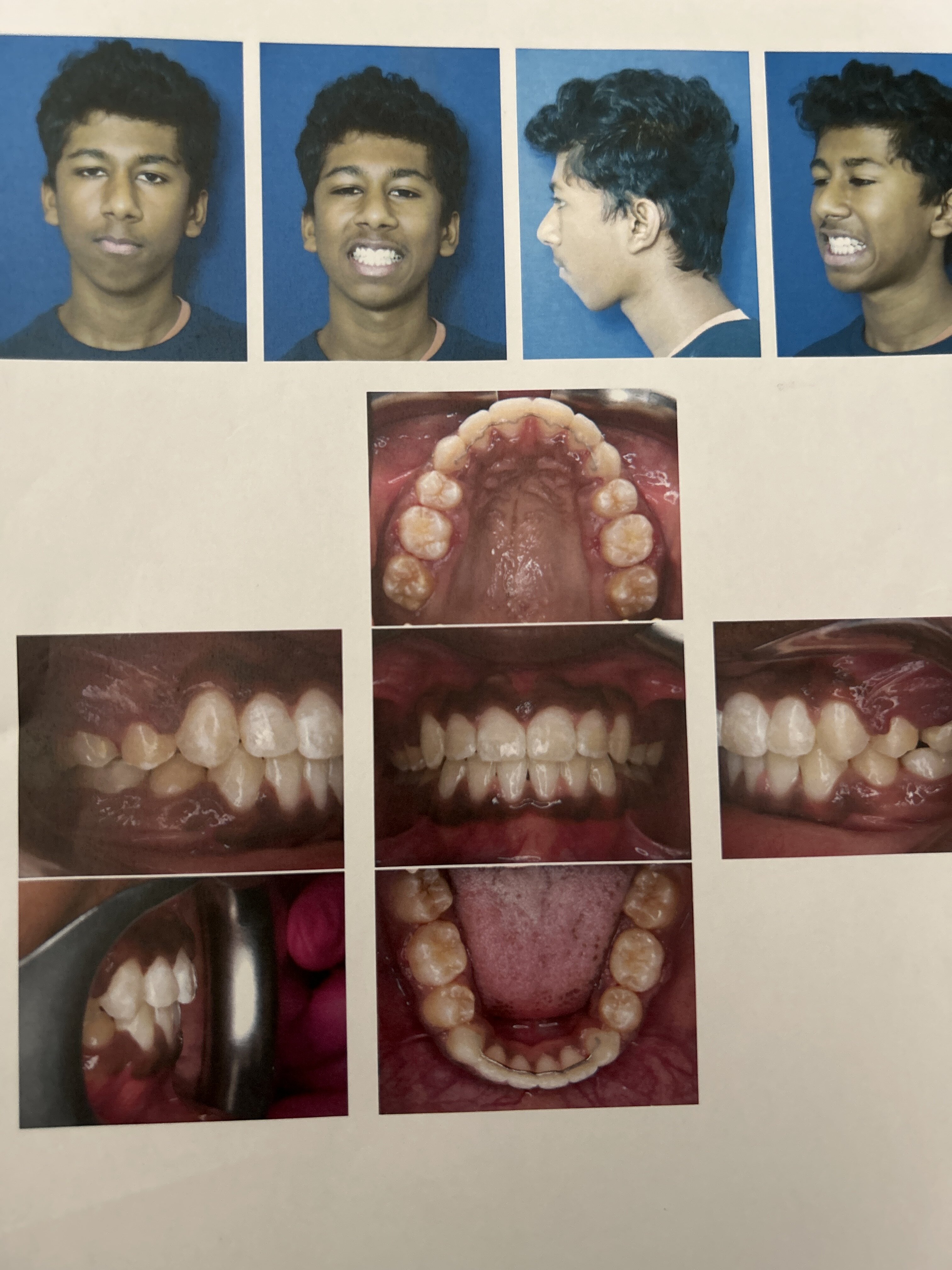 Image Image