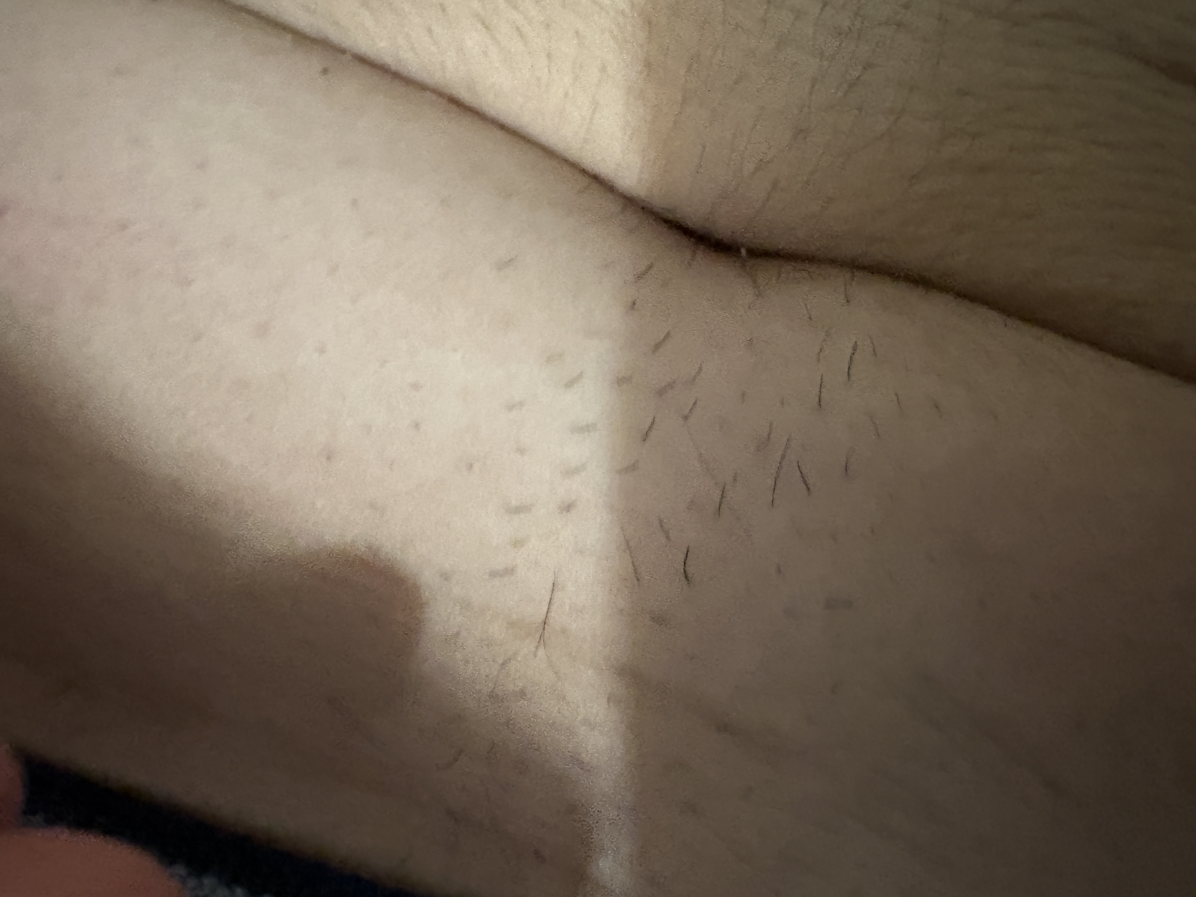 IMG 0845