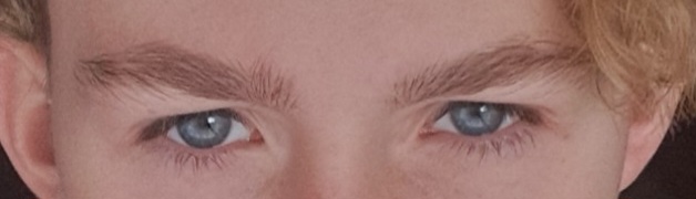 1000018156