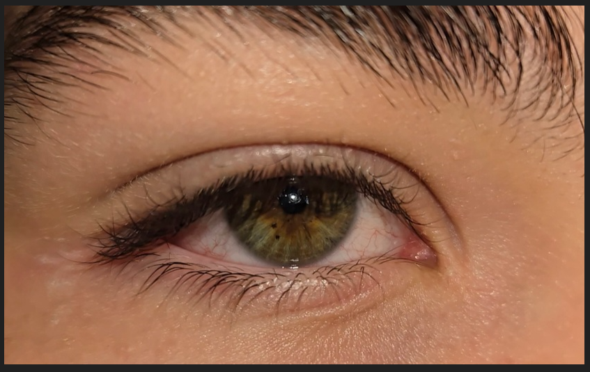 Eye