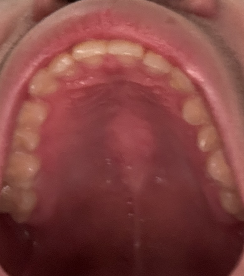 IMG 1357