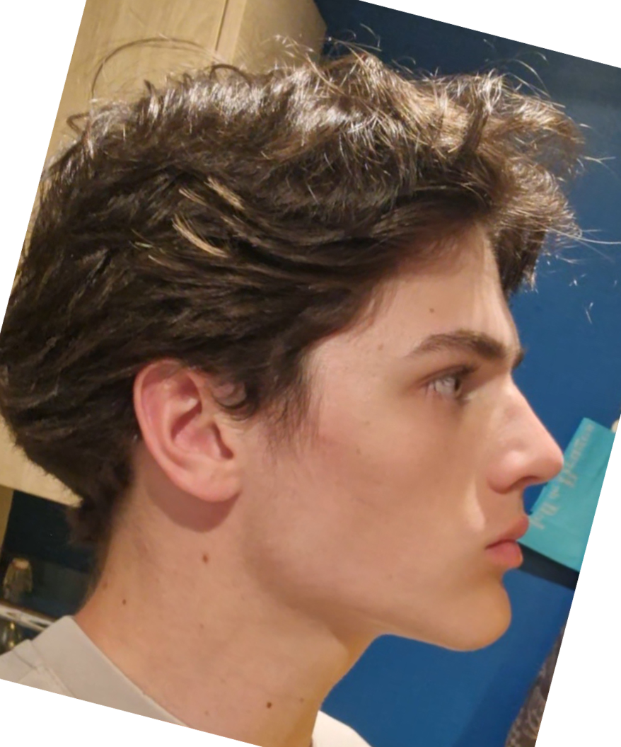 Sidefix