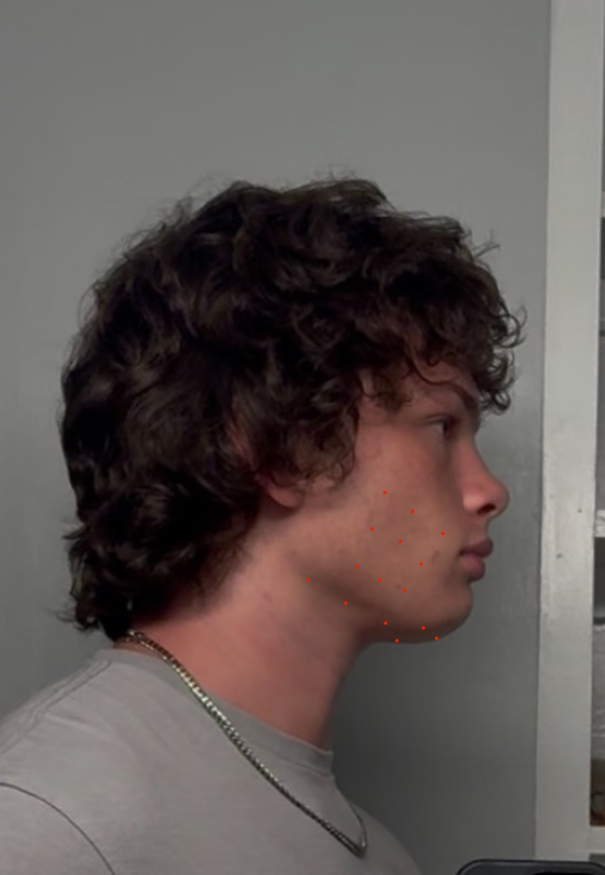 IMG 0430