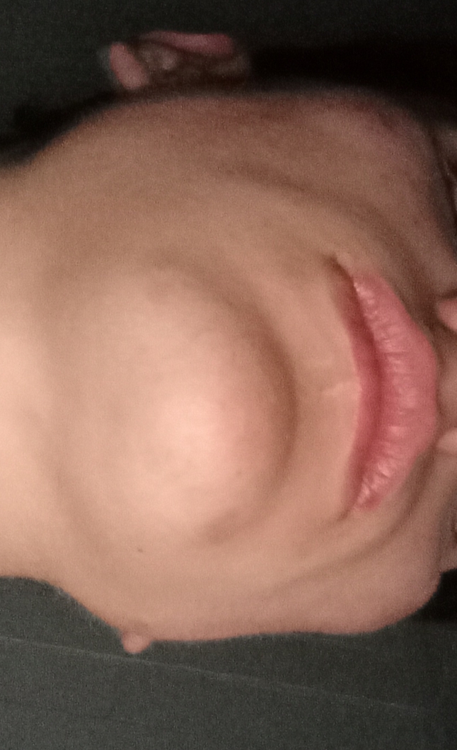 1000032254 1000032254