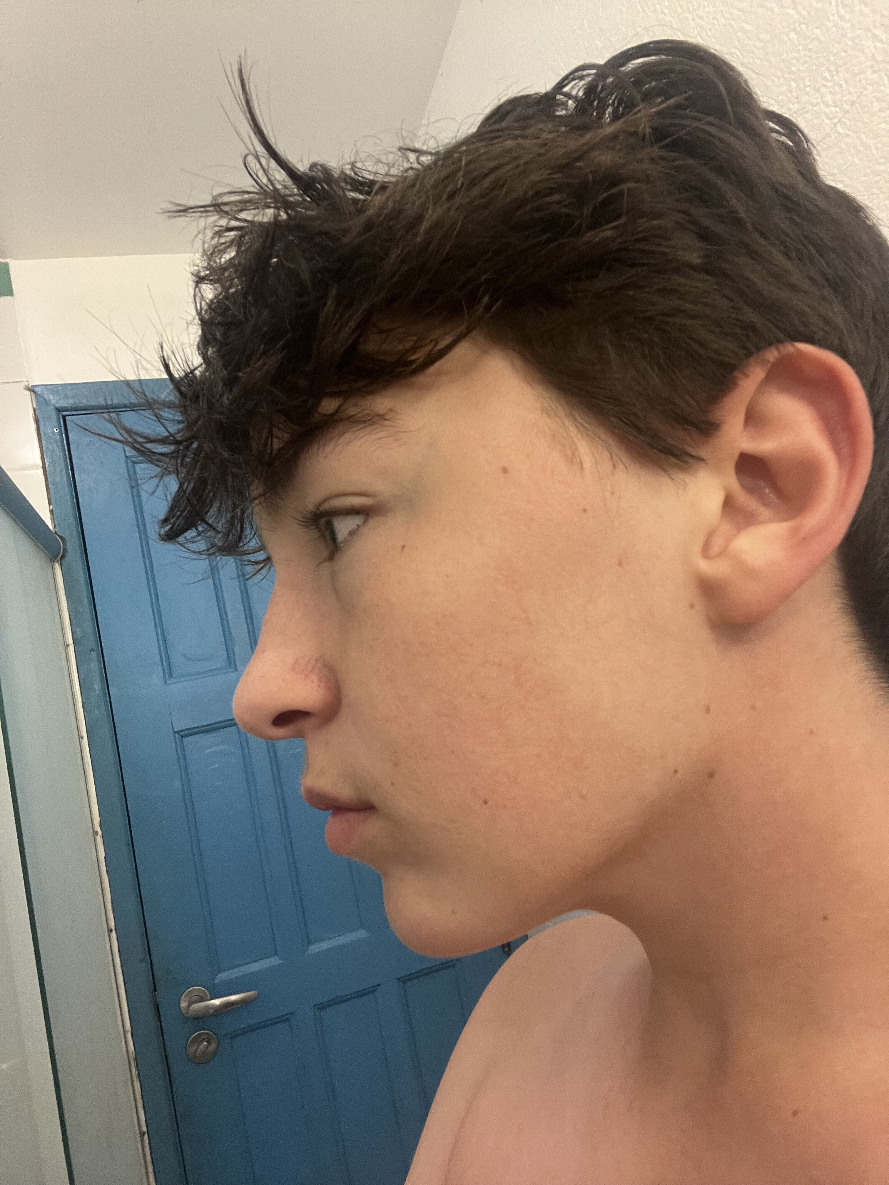 IMG 1241