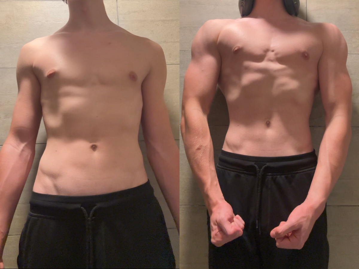 Before and After
