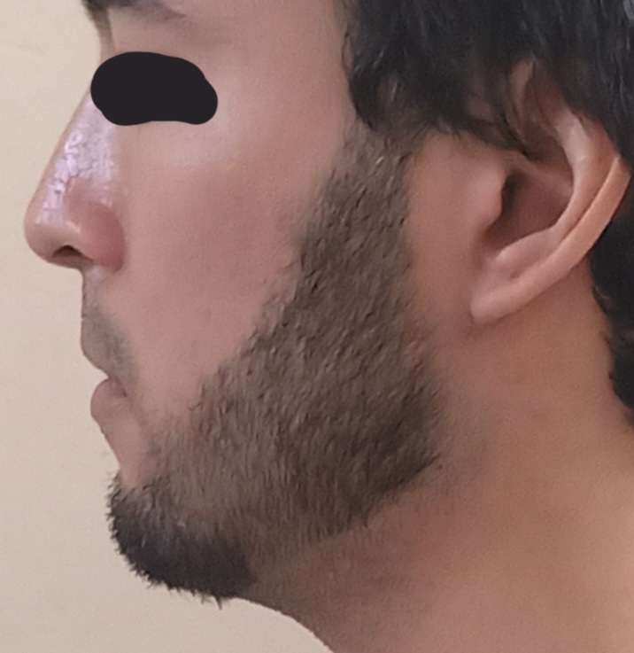 20250721 165303 1