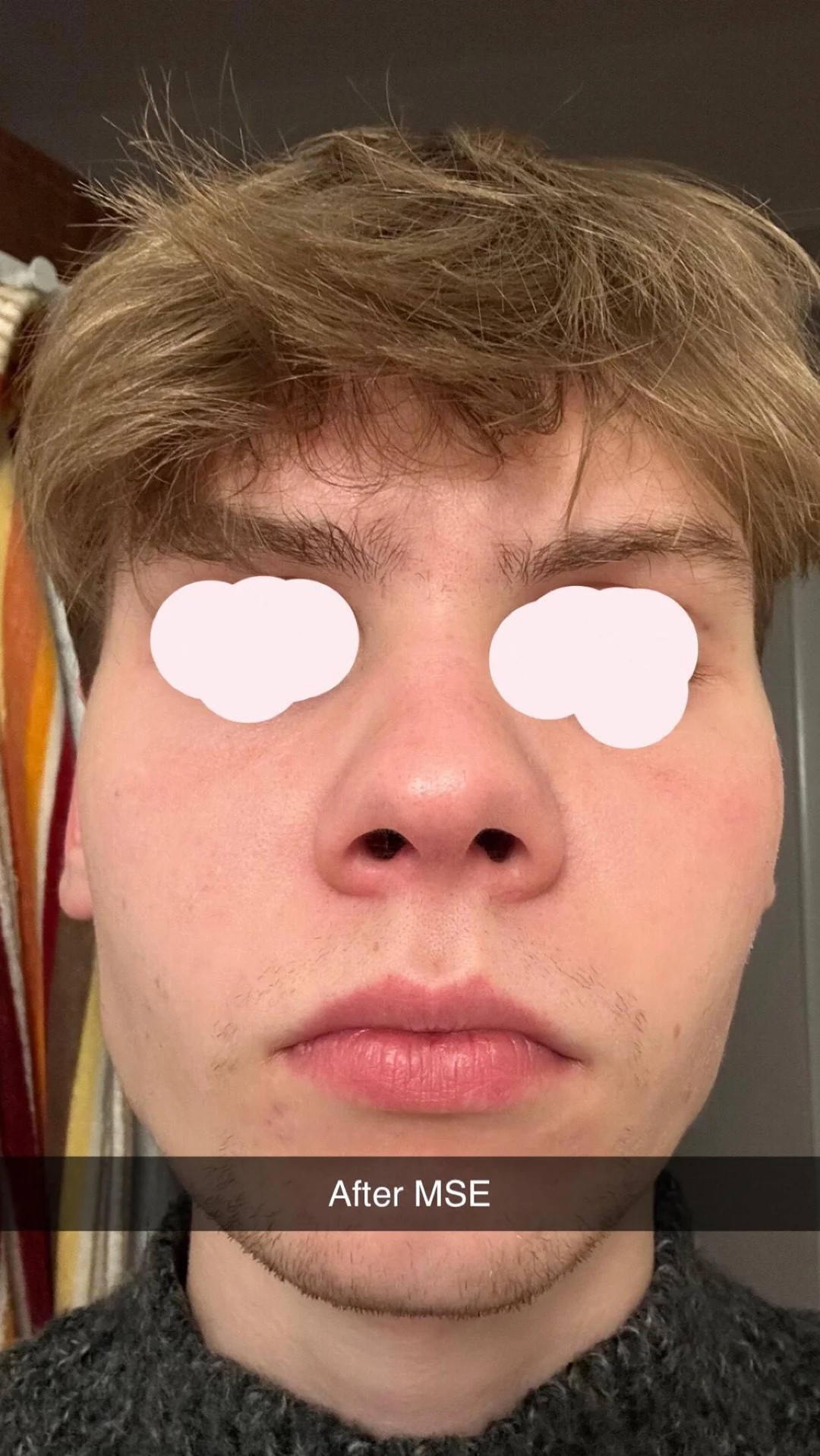 Mse before and after insane v0 kla8o0l78fsc1 Mse before and after insane v0 kla8o0l78fsc1