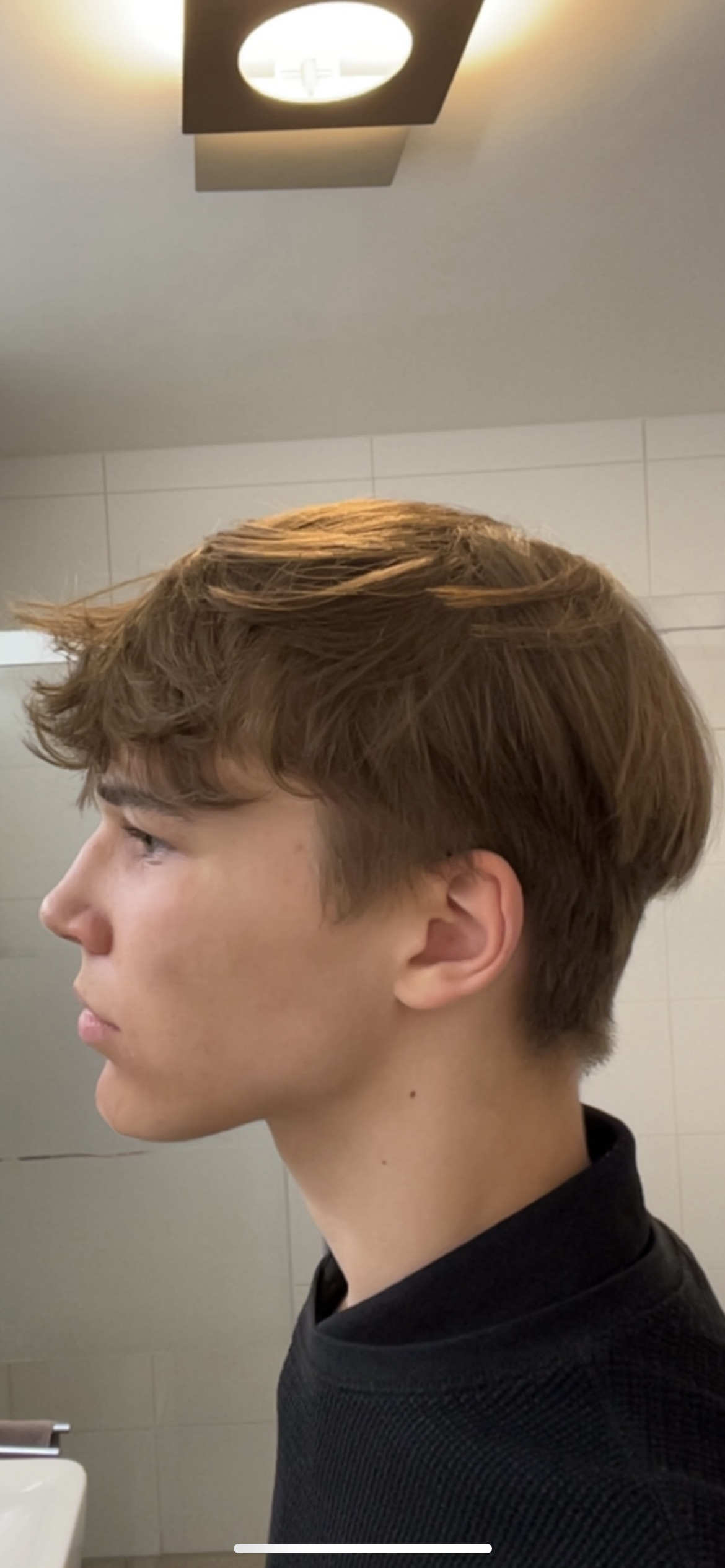 Morph chin