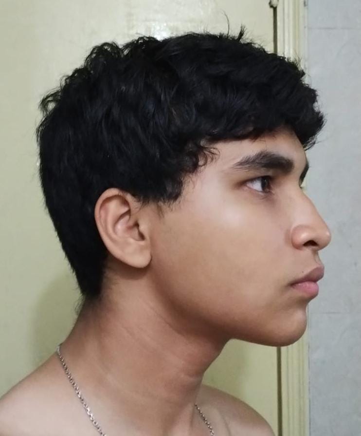 1000036562