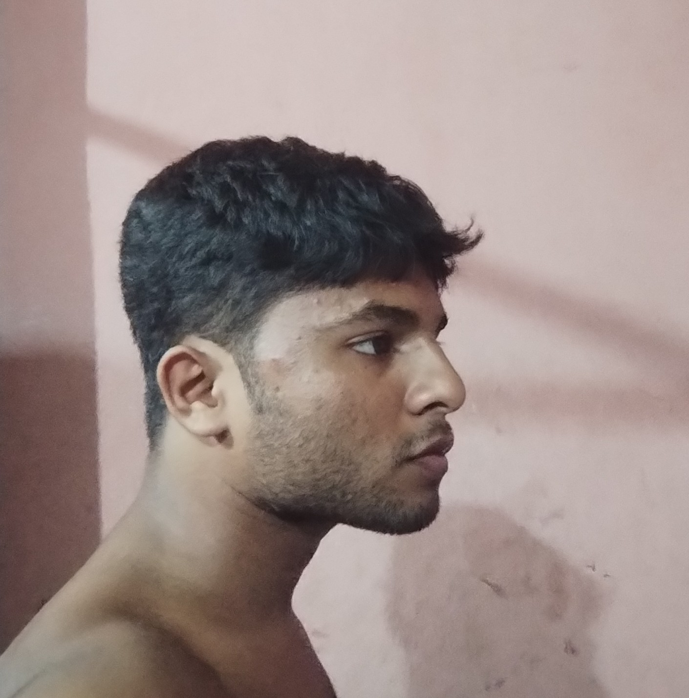 1000047912