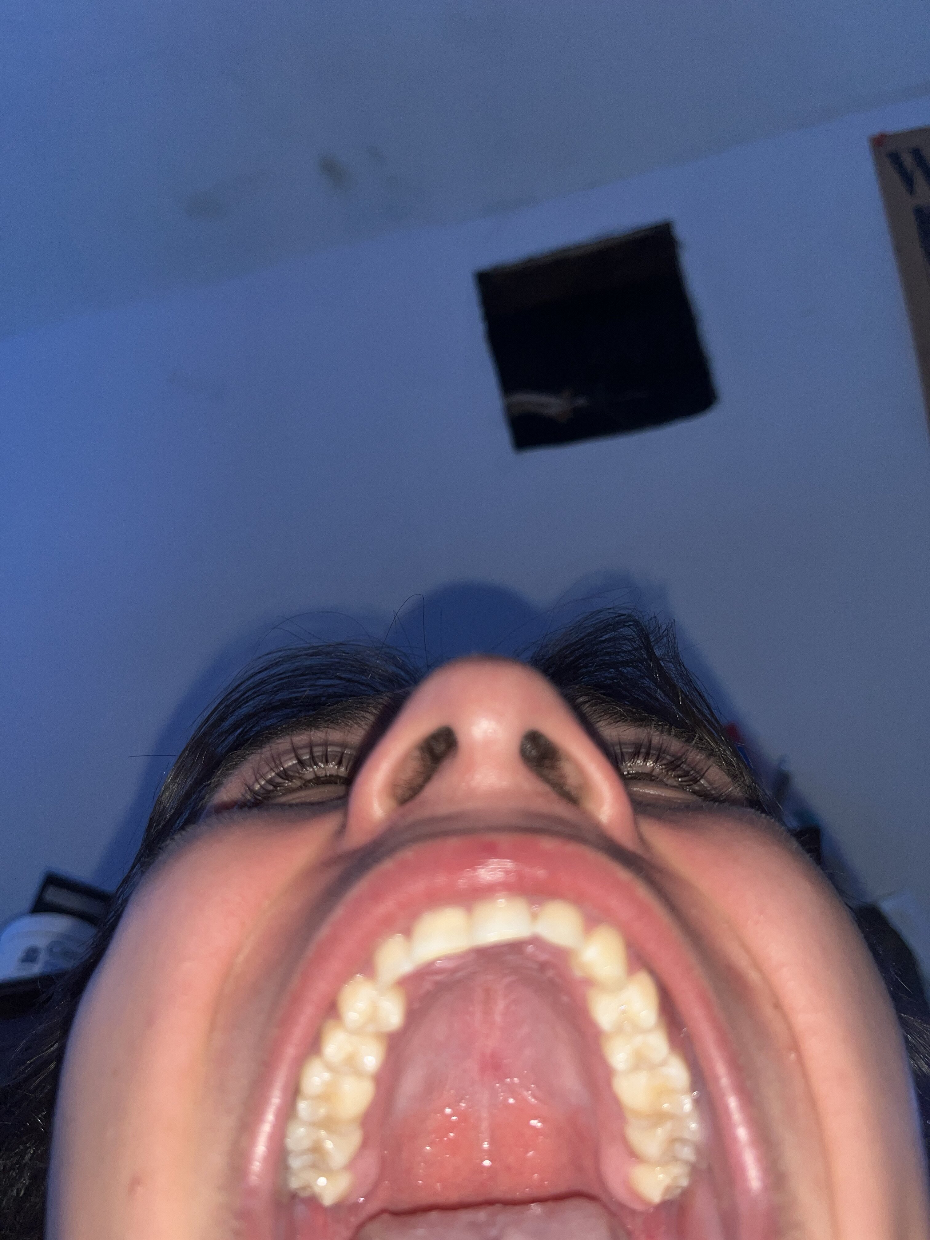 IMG 3326