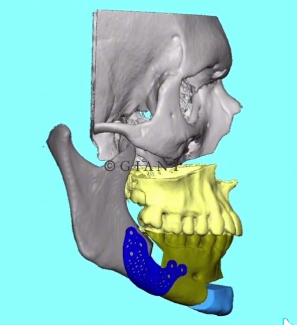 A1bef3db ad17 4b37 a606 9b1e4d99d414