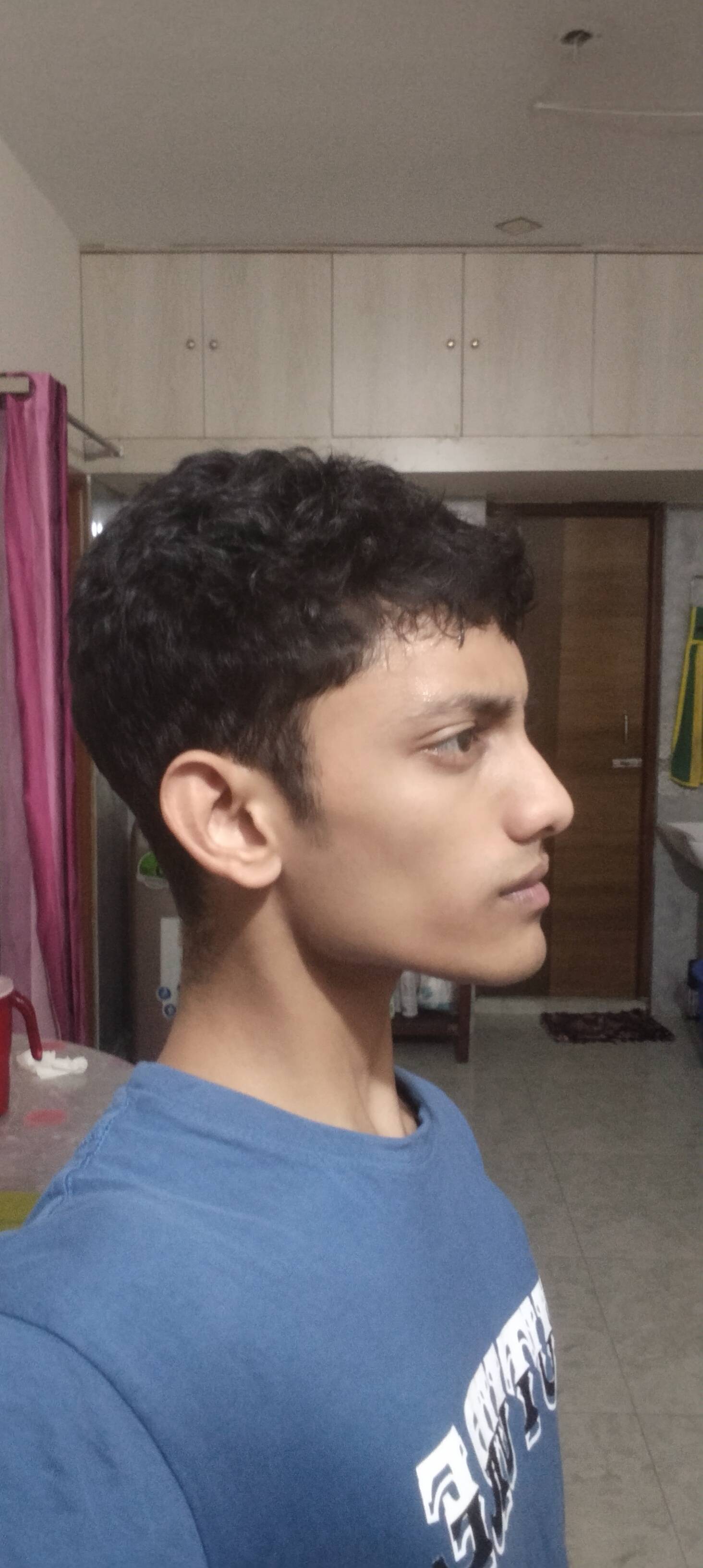 1000028241