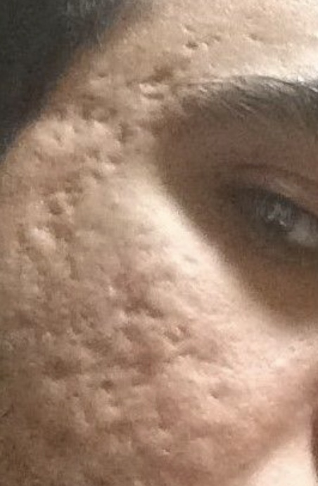 4431459 2891589 D01B4BFA 8772 4163 B34D E0CBF19279CF