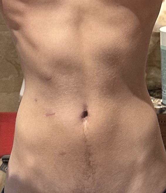 Waist