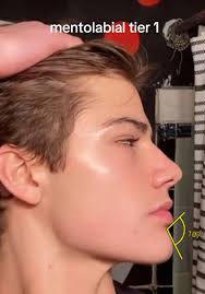 IMG 0908