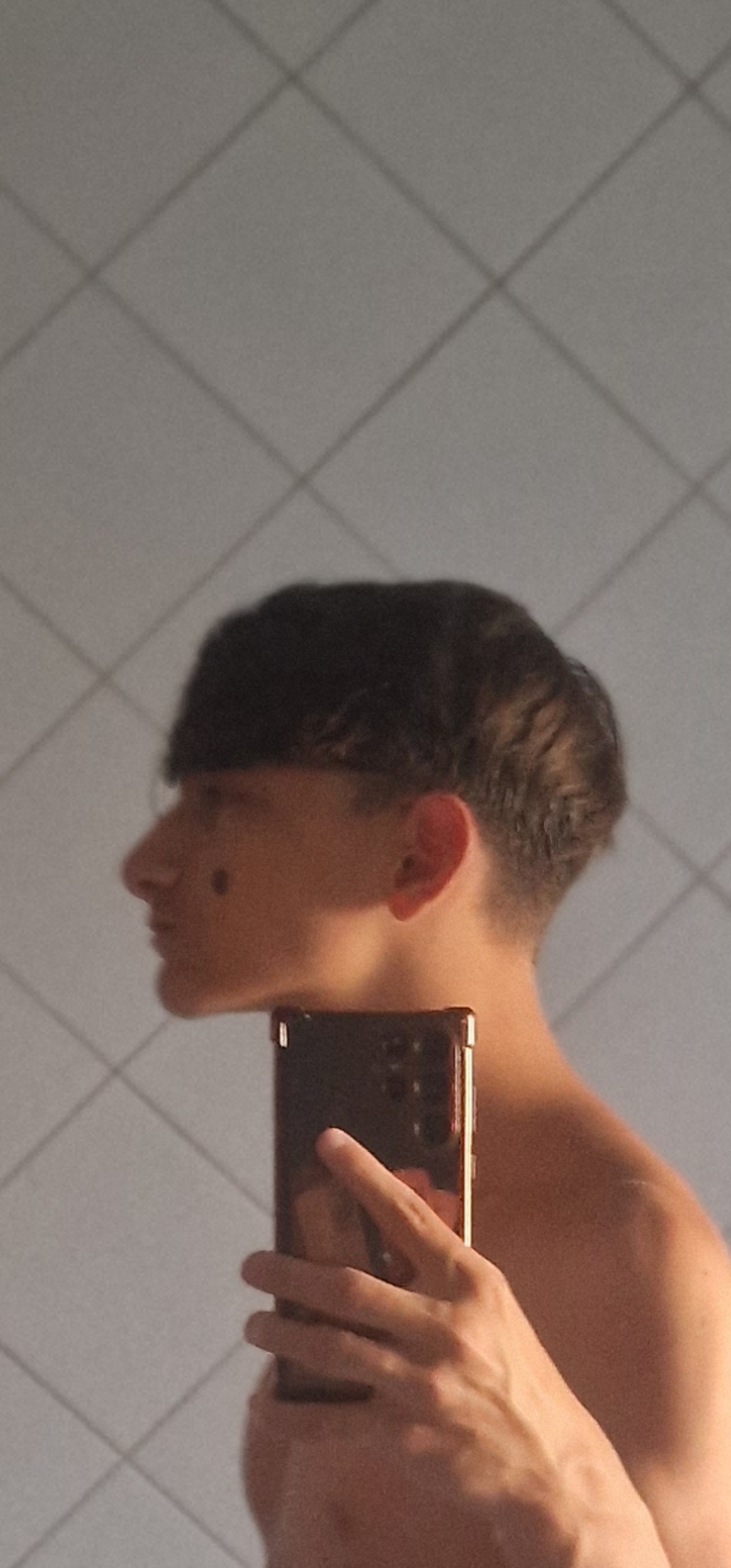 1000135141