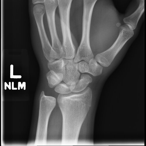 hand lmwr.jpg