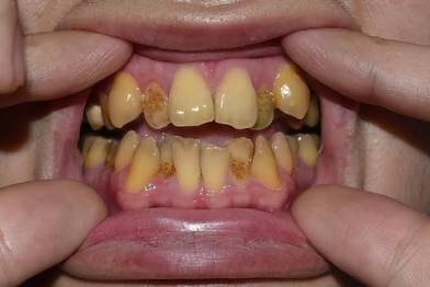 IMG 0835 IMG 0835