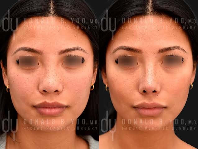 Images 2025 07 13T224208195 Images 2025 07 13T224208195