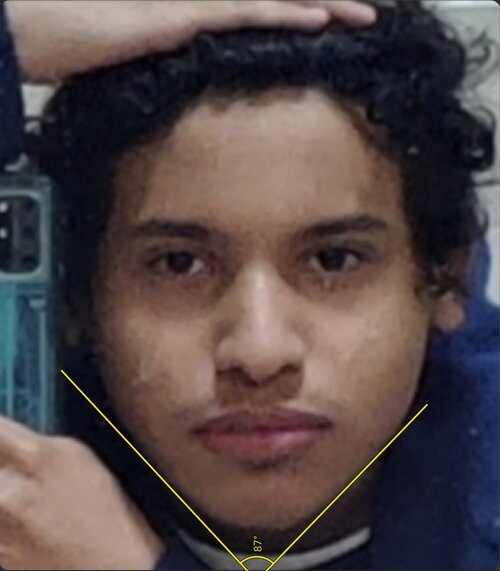Screenshot 20250714 124745 ImageMeter