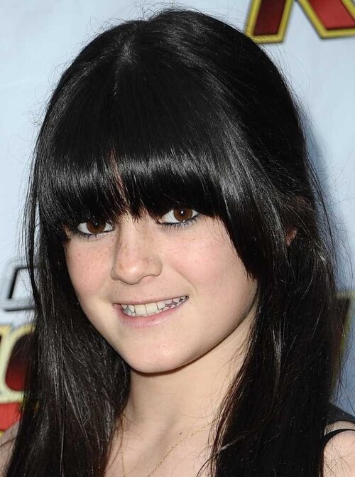 3365143 before and after pictures kylie jenner plastic surgery history