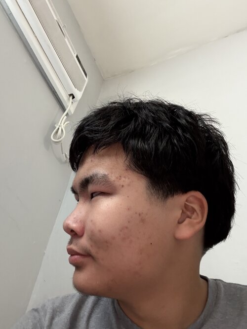 IMG 1351