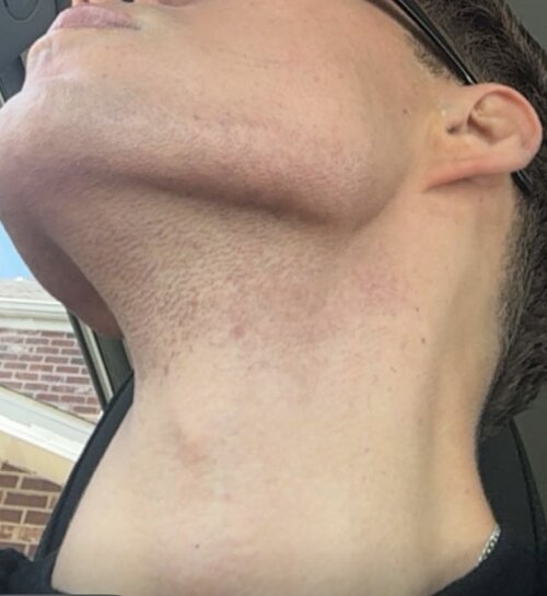 IMG 1013