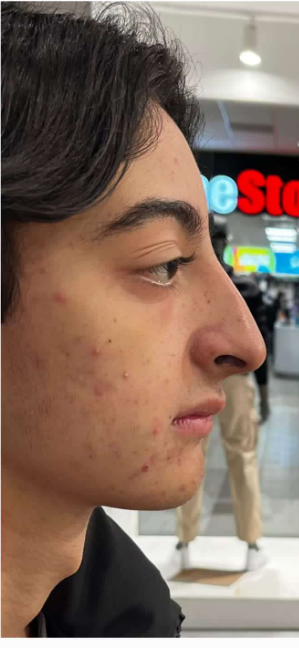 v9zhu8xvuhyizxvzv.png