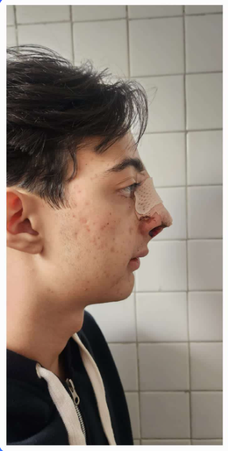 v9zx90vj8z90xvzxv.png